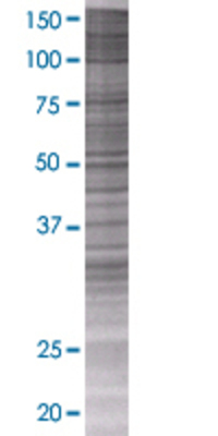 FCRLB transfected lysate.