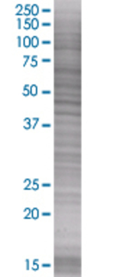 PPARA transfected lysate