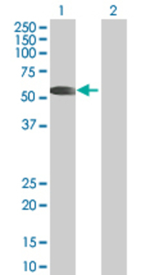 Lane 1: PPP5C transfected lysate (56.9 KDa) Lane 2: Non-transfected lysate.