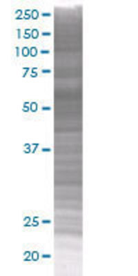 PPP5C transfected lysate.