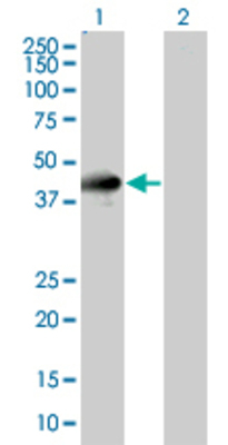 Lane 1: ICAM2 transfected lysate (30.36 KDa) Lane 2: Non-transfected lysate.