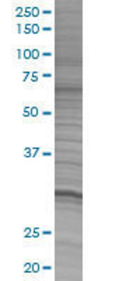 FBXO6 transfected lysate.