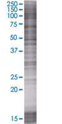 NDUFS2 transfected lysate.