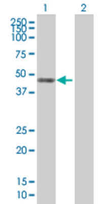 Lane 1: TXNDC5 transfected lysate (40.4 KDa) Lane 2: Non-transfected lysate.