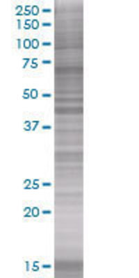 MVD transfected lysate
