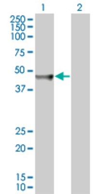 Lane 1: MVD transfected lysate (44 KDa). Lane 2: Non-transfected lysate.