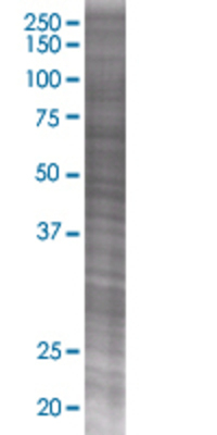 DCXR transfected lysate.