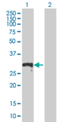 Lane 1: DCXR transfected lysate (26.84 KDa) Lane 2: Non-transfected lysate.