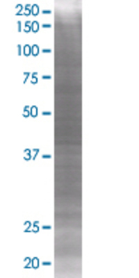 M6PRBP1 transfected lysate.