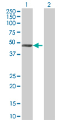 Lane 1: M6PRBP1 transfected lysate (47 KDa) Lane 2: Non-transfected lysate.