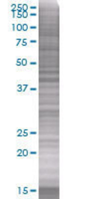 CENTA2 transfected lysate