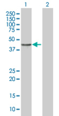 Lane 1: CENTA2 transfected lysate (41.91 KDa). Lane 2: Non-transfected lysate.