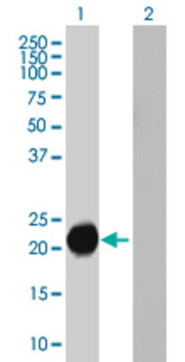 Lane 1: CSH2 transfected lysate (23.98 KDa). Lane 2: Non-transfected lysate.