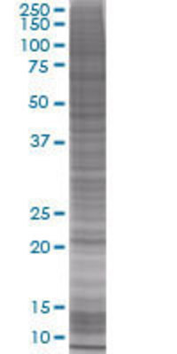 CSH2 transfected lysate