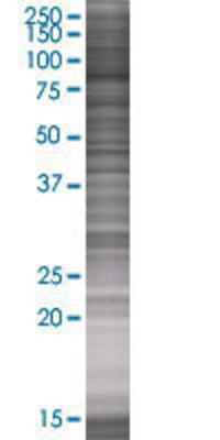 SUPV3L1 transfected lysate.