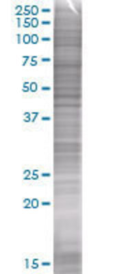 RNF141 transfected lysate.