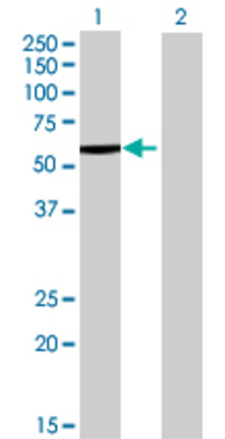 Lane 1: CES1 transfected lysate (62.37 KDa) Lane 2: Non-transfected lysate.