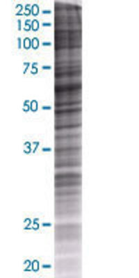 CES1 transfected lysate.