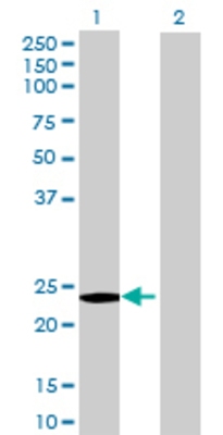 Lane 1: TFPI2 transfected lysate (25.96 KDa) Lane 2: Non-transfected lysate.