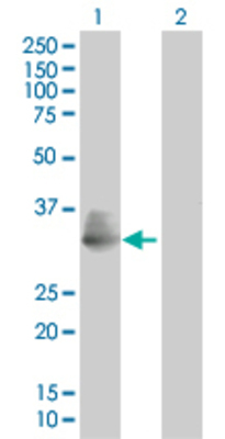 Lane 1: TIRAP transfected lysate (28.27 KDa). Lane 2: Non-transfected lysate.