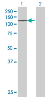 Lane 1: RASA1 transfected lysate (100.4 KDa) Lane 2: Non-transfected lysate.