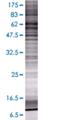 PDE1A transfected lysate.