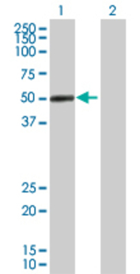 Lane 1: PDHA1 transfected lysate (43.01 KDa) Lane 2: Non-transfected lysate.
