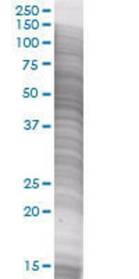 PROC transfected lysate.