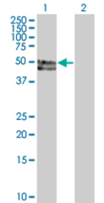 Lane 1: PROC transfected lysate (52.1 KDa) Lane 2: Non-transfected lysate.