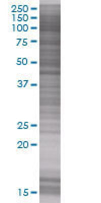 DNASE2 transfected lysate.
