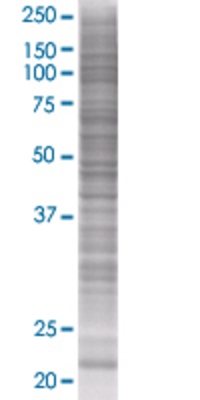VHL transfected lysate.