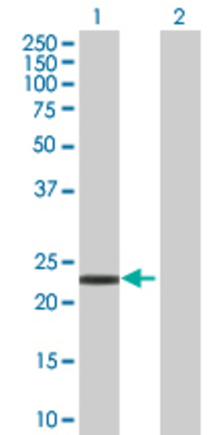 Lane 1: VHL transfected lysate (19.7 KDa) Lane 2: Non-transfected lysate.