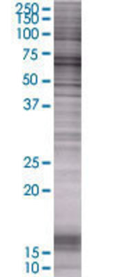 HDAC1 transfected lysate.