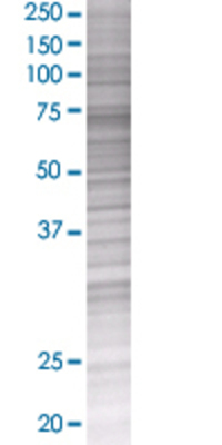 MTHFR transfected lysate.