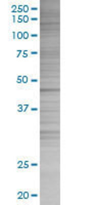 FASN transfected lysate.
