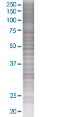 BPNT1 transfected lysate.