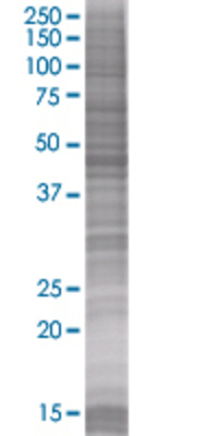 PUS1 transfected lysate