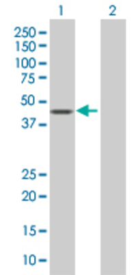 Lane 1: PUS1 transfected lysate (44 KDa). Lane 2: Non-transfected lysate.