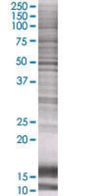PDE7B transfected lysate.