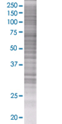 CDK5 transfected lysate.