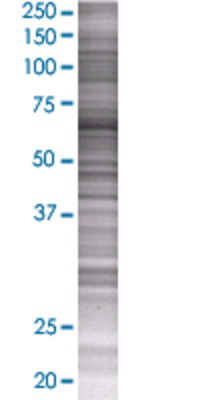EPS8L1 transfected lysate.