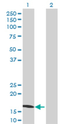 Lane 1: PLA2G10 transfected lysate (18.26 KDa) Lane 2: Non-transfected lysate.