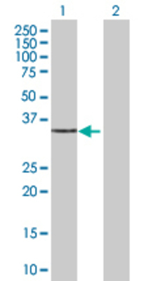 Lane 1: CAPZA2 transfected lysate (31.57 KDa) Lane 2: Non-transfected lysate.