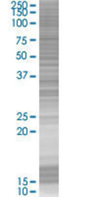 CAPZA2 transfected lysate.