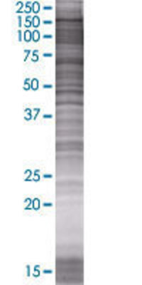 PITPNM1 transfected lysate.
