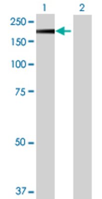 Lane 1: PITPNM1 transfected lysate (136.84 KDa) Lane 2: Non-transfected lysate.