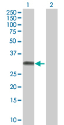 Lane 1: HUS1 transfected lysate (31.7 KDa) Lane 2: Non-transfected lysate.