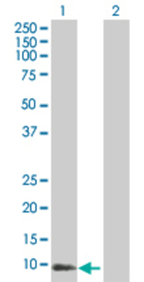 Lane 1: PROK1 transfected lysate (11.66 KDa). Lane 2: Non-transfected lysate.