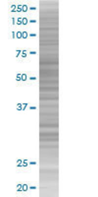 ESD transfected lysate.