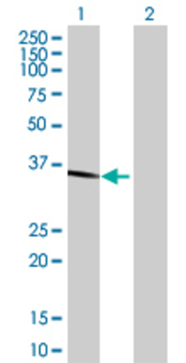 Lane 1: ESD transfected lysate (31.13 KDa) Lane 2: Non-transfected lysate.